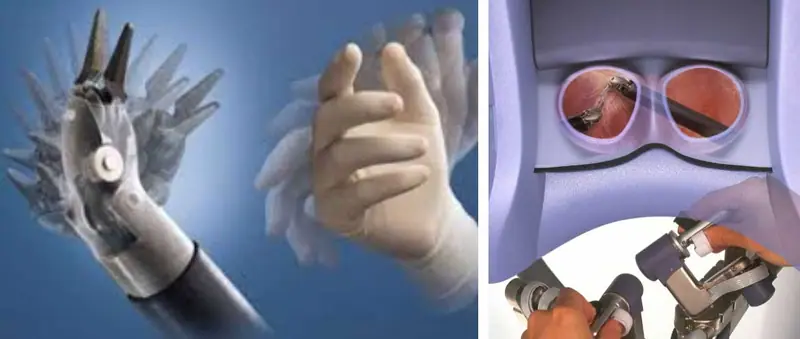 CHIRURGIE ROBOT ASSISTEE — photo 4